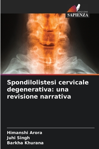 Spondilolistesi cervicale degenerativa