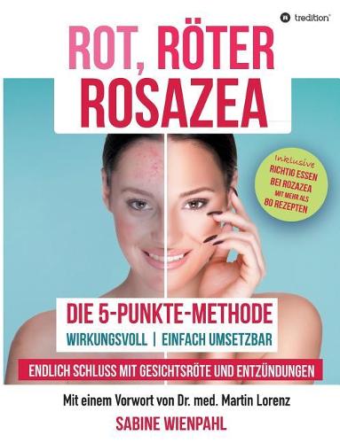 Rot Röter Rosazea