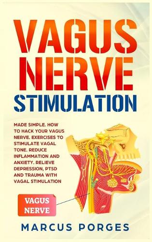 Vagus Nerve Stimulation