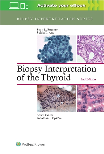 Biopsy Interpretation of the Thyroid: (Biopsy Interpretation Series)
