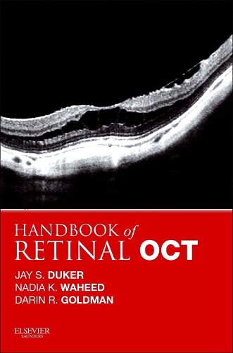 Handbook of Retinal Oct: Optical Coherence Tomography E-Book