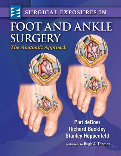Surgical Exposures in Foot & Ankle Surgery: The Anatomic Approach