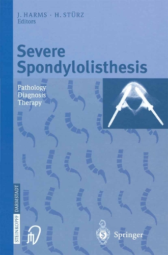 Severe Spondylolisthesis: Pathology - Diagnosis - Therapy(English)