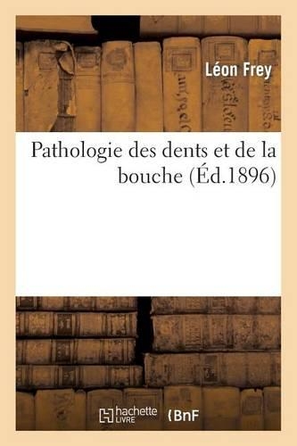 Pathologie Des Dents Et de la Bouche: (Sciences)