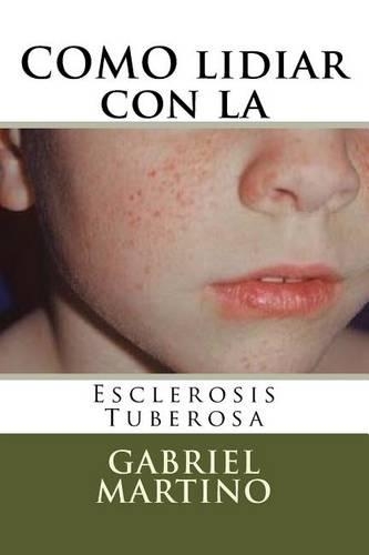 Como Lidiar Con La Esclerosis Tuberosa: (Spanish)