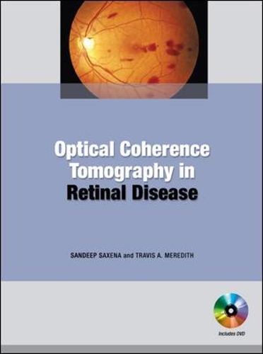 Optical Coherence Tomography in Retinal Disease