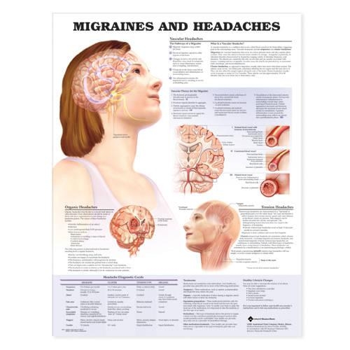 Migraines & Headaches