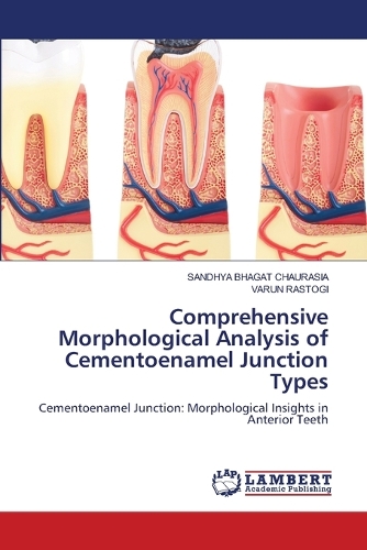 Comprehensive Morphological Analysis of Cementoenamel Junction Types