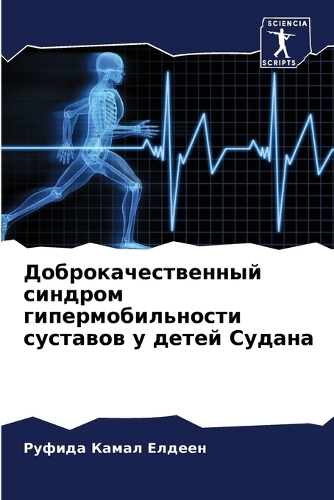 Доброкачественный синдром гипермобильн&#