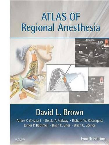 Atlas of Regional Anesthesia E-Book
