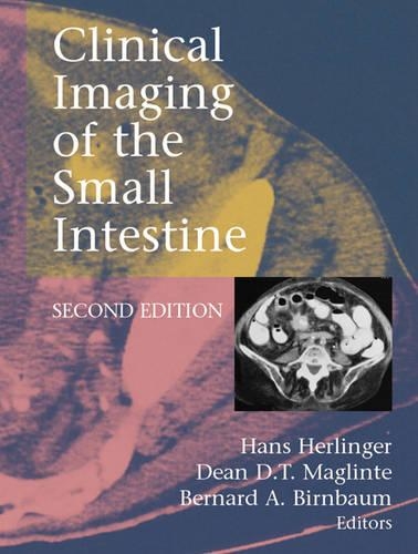 Clinical Imaging of the Small Intestine