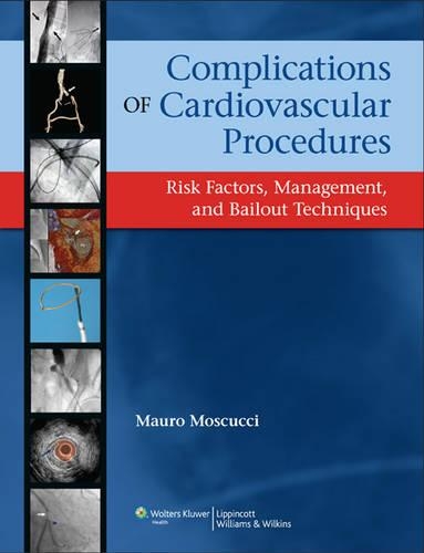 Complications of Cardiovascular Procedures