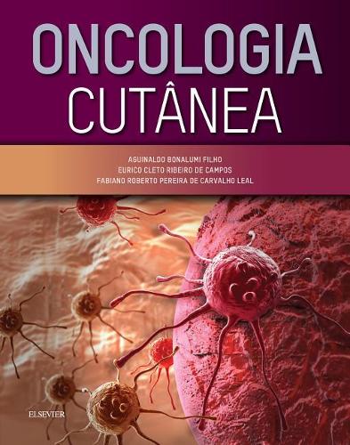 Oncologia Cutanea