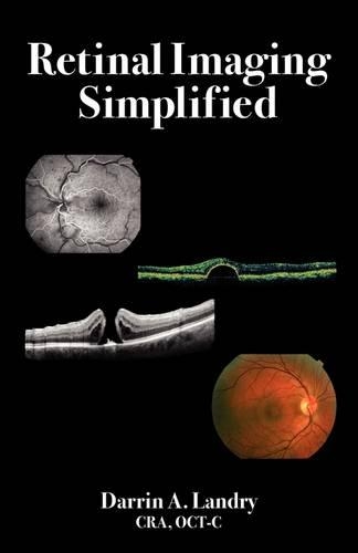 Retinal Imaging Simplified: (English)