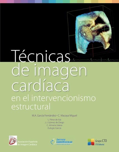 Tecnicas de Imagen Cardiaca: (English)