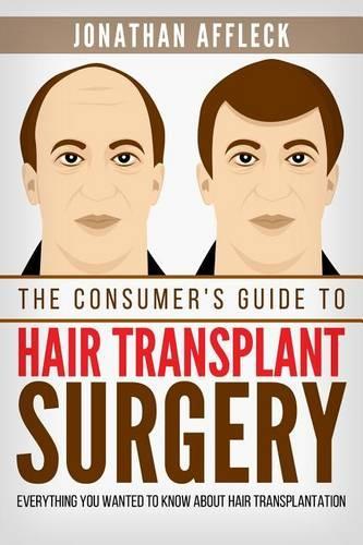 The Consumer's Guide to Hair Transplant Surgery: Everything You Wanted to Know About Hair Transplantation