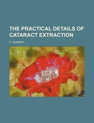 The Practical Details of Cataract Extraction