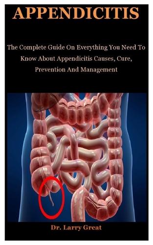 Appendicitis