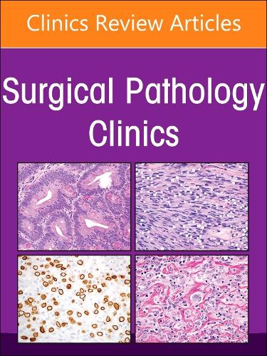 Soft Tissue Pathology, an Issue of Surgical Pathology Clinics, E-Book: Soft Tissue Pathology, an Issue of Surgical Pathology Clinics, E-Book(17 Clinics: Surgery)
