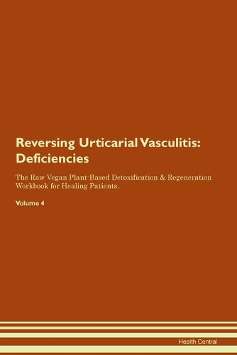 Reversing Urticarial Vasculitis