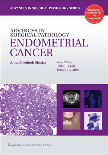 Endometrial Cancer
