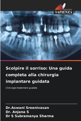 Scolpire il sorriso: Una guida completa alla chirurgia implantare guidata