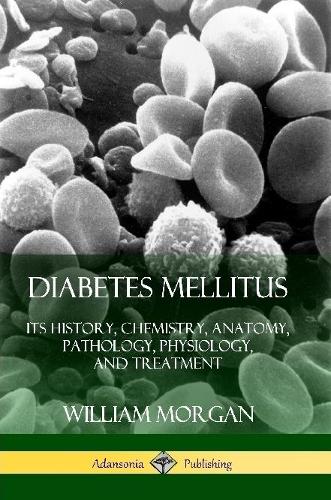 Diabetes Mellitus: Its History, Chemistry, Anatomy, Pathology, Physiology, and Treatment