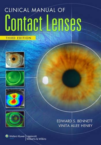Clinical Manual of Contact Lenses