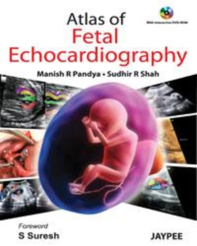Atlas of Fetal Echocardiography