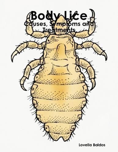 Body Lice: Causes, Symptoms and Treatments