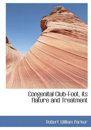 Congenital Club-Foot, Its Nature and Treatment