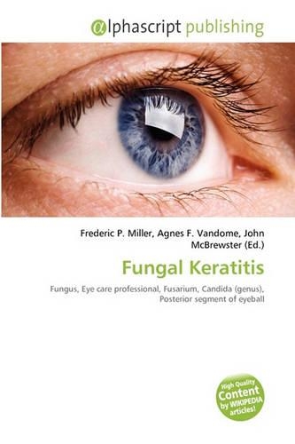 Fungal Keratitis: (English)