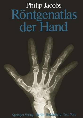 Rontgenatlas Der Hand