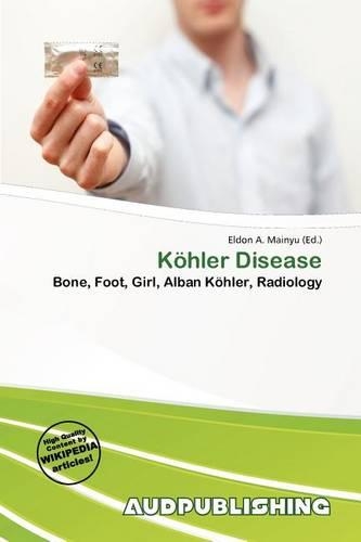 K Hler Disease: (English)