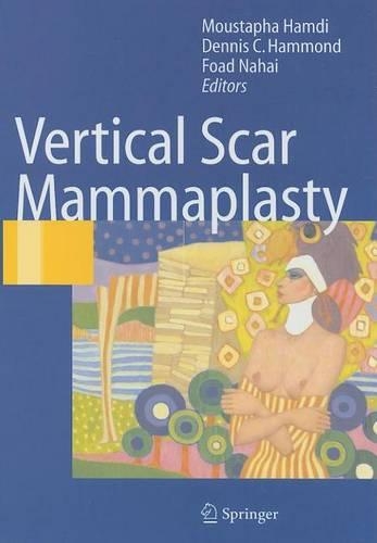 Vertical Scar Mammaplasty