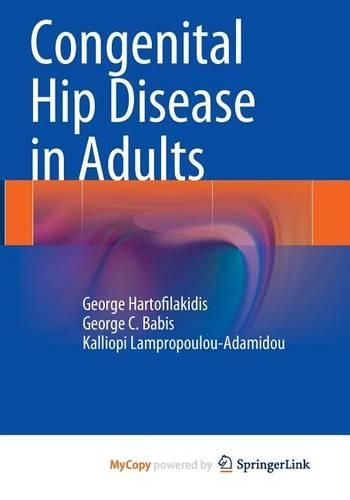 Congenital Hip Disease in Adults