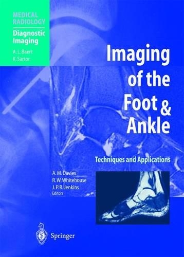 Imaging of the Foot and Ankle