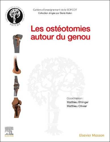 Les Ostéotomies Autour Du Genou