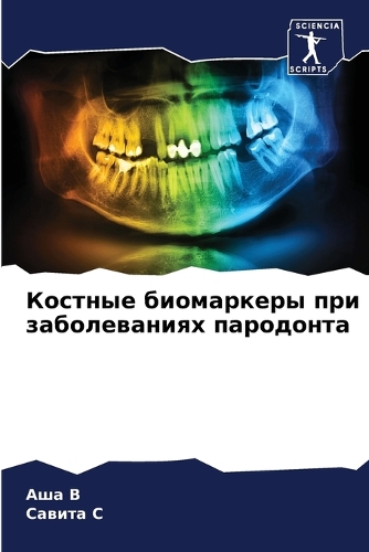 &#1050;&#1086;&#1089;&#1090;&#1085;&#1099;&#1077; &#1073;&#1080;&#1086;&#1084;&#1072;&#1088;&#1082;&#1077;&#1088;&#1099; &#1087;&#1088;&#1080; &#1079;&#1072;&#1073;&#1086;&#1083;&#1077;&#1074;&#1072;&#1085;&#1080;&#1103;&#1093; &#1087;&#1072;&#1088