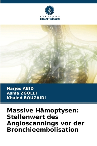 Massive Hämoptysen: Stellenwert des Angioscannings vor der Bronchieembolisation