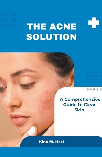 The Acne Solution