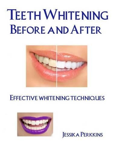 Teeth Whitening Before and After: Effective Whitening Techniques(English)
