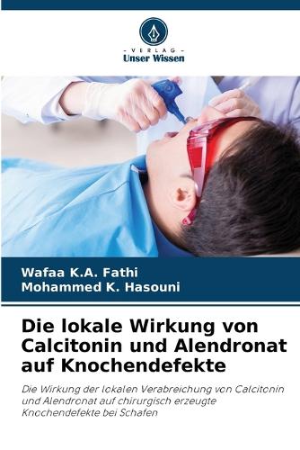 Die lokale Wirkung von Calcitonin und Alendronat auf Knochendefekte