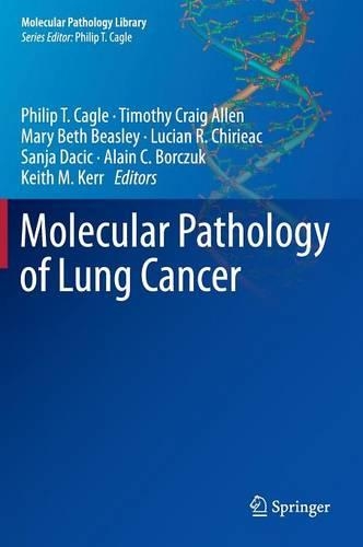 Molecular Pathology of Lung Cancer