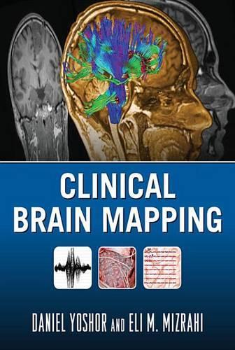 Clinical Brain Mapping (Ebook)