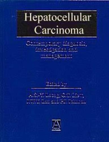 Hepatocellular Carcinoma