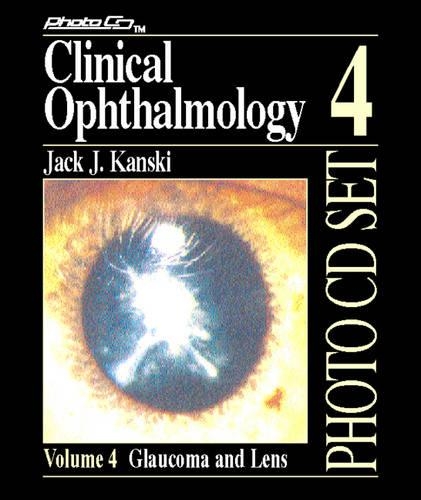 Clinical Ophthalmology