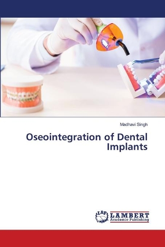Oseointegration of Dental Implants