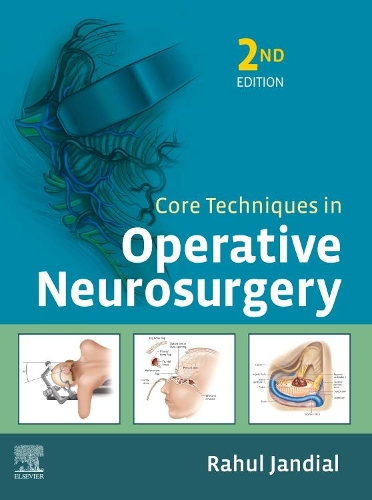 Core Techniques in Operative Neurosurgery E-Book