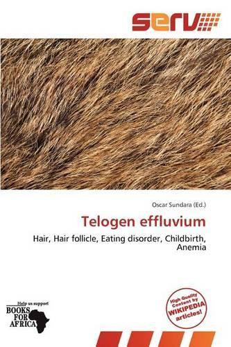 Telogen Effluvium: (English)